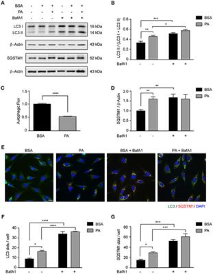 Palmitic Acid Reduces the Autophagic Flux and Insulin Sensitivity Through the Activation of the Free Fatty Acid Receptor 1 (FFAR1) in the Hypothalamic Neuronal Cell Line N43/5